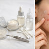 Parches acne vs secantes: cuál elegir para un brote