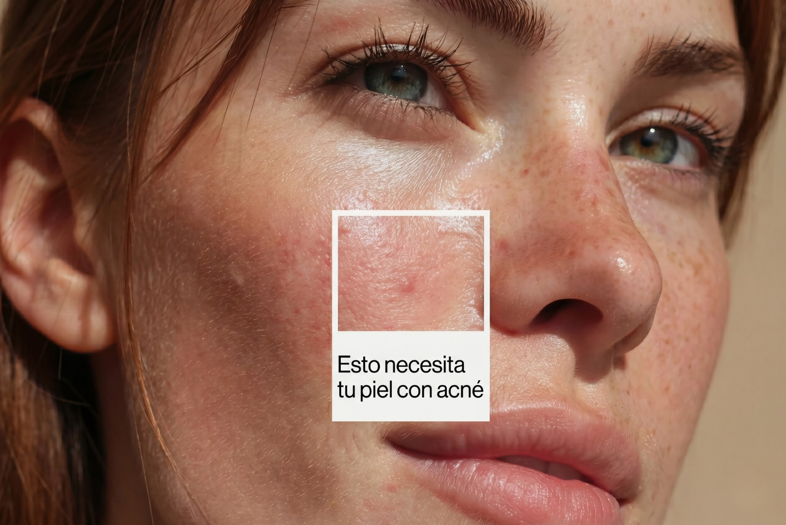 Skincare coreano para acne que sí funciona