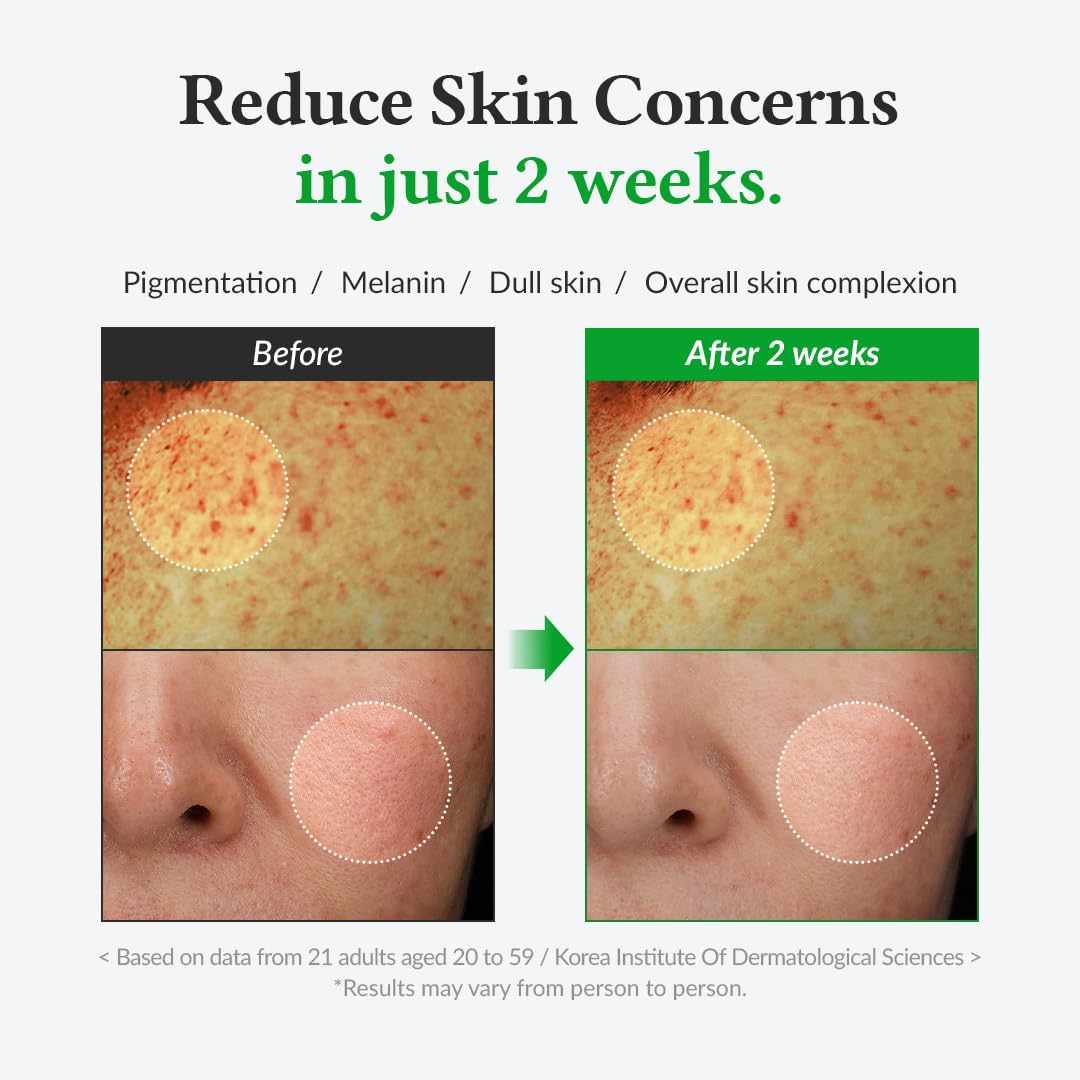 DR. ALTHEA - Gentle Vitamin C Serum 30 ML | Suero Iluminador 4