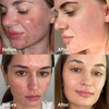 MEDICUBE - Red Succinic Acid Clarifying Serum 30 ML | Serum Exfoliante Antiacne 4
