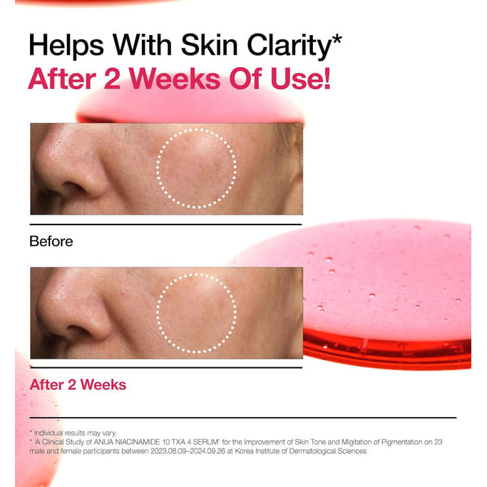 ANUA - Niacinamide 10% + TXA 4% Serum 30 ML | Suero Antimanchas